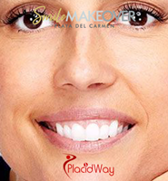 Slider image (4) Smile Makeover Playa Del Carmen